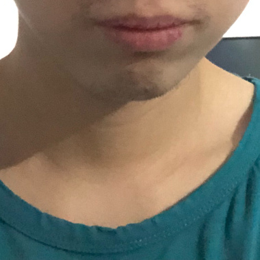 頂到天