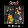 Bureaucracy (Live)