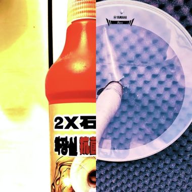 肛門