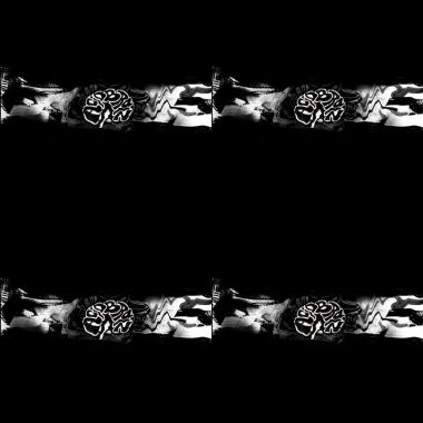 酸腦