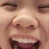 蒜頭鼻