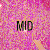 M!D