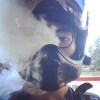 蜂窩性組織炎