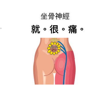 坐骨神經痛
