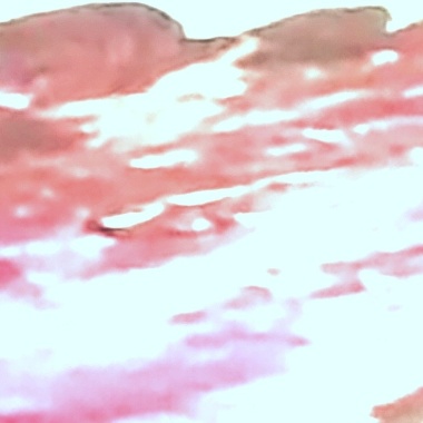 枝干之下—成人