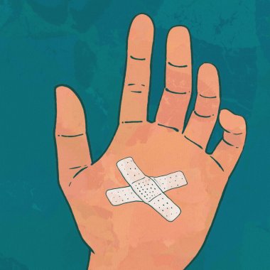 我真的受傷了 ( 講的是手指 )