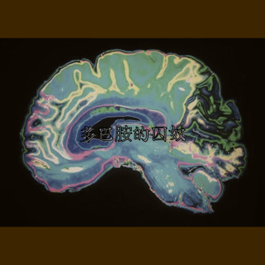 多巴胺的囚奴